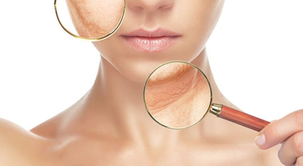 Wrinkles can be effectively eliminated with laser treatment